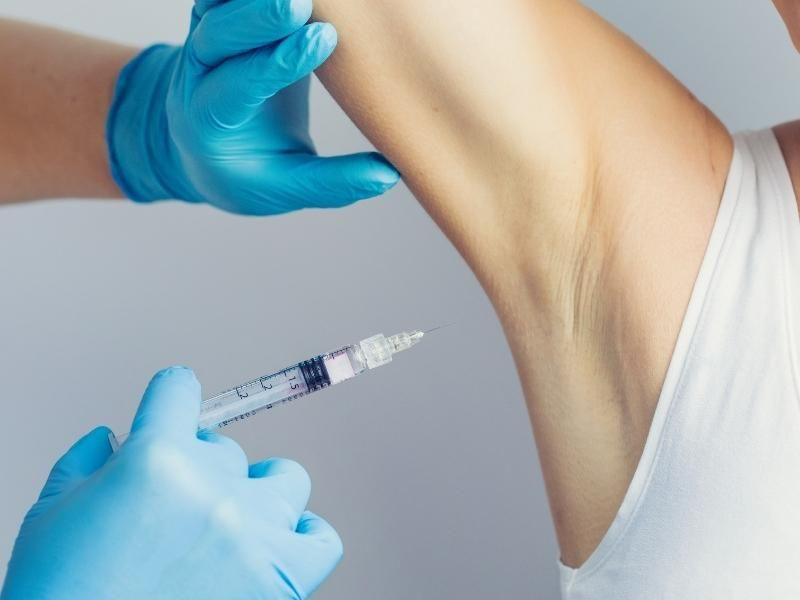 Phương pháp tiêm Botulinum toxin để giảm tiết mồ hôi vùng nách chuẩn y khoa