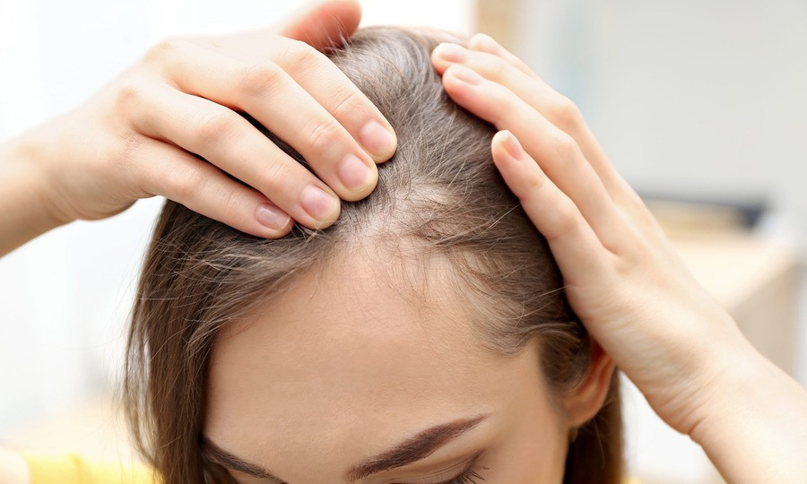 Các yếu tố tổn thương tóc và da đầu