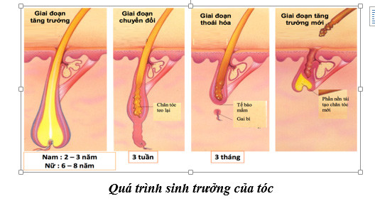 Căng thẳng dẫn đến rụng tóc như thế nào?