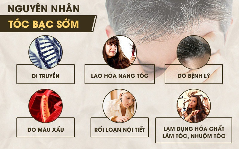 Một số nguyên nhân gây tóc bạc sớm