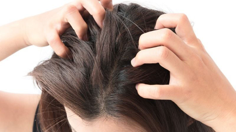 Tuyệt đối không gãi mạnh da đầu